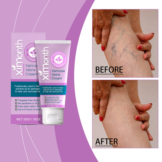 XIMONTH vein repair cream relieves leg swelling earthworm leg varicose vein massage body care cream